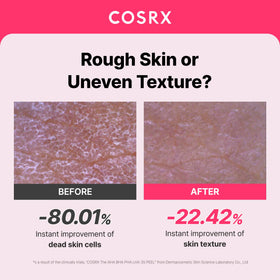 COSRX AHA BHA PHA LHA 35% Peel Exfoliating Gel texture close-up