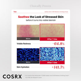COSRX Azelaic Acid 10 B5 Cream Gel ingredients list