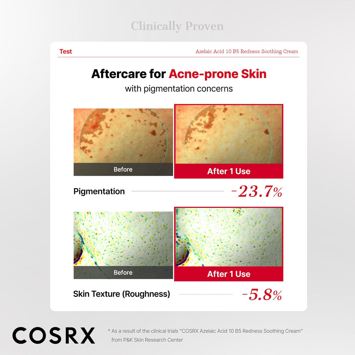 COSRX Azelaic Acid 10 B5 Cream Gel lifestyle scene