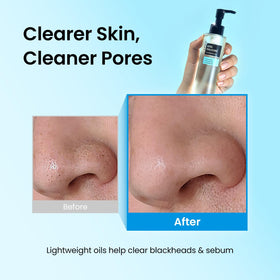 coxir Ultra Hyaluronic Cleansing Oil with makeup removal cloth