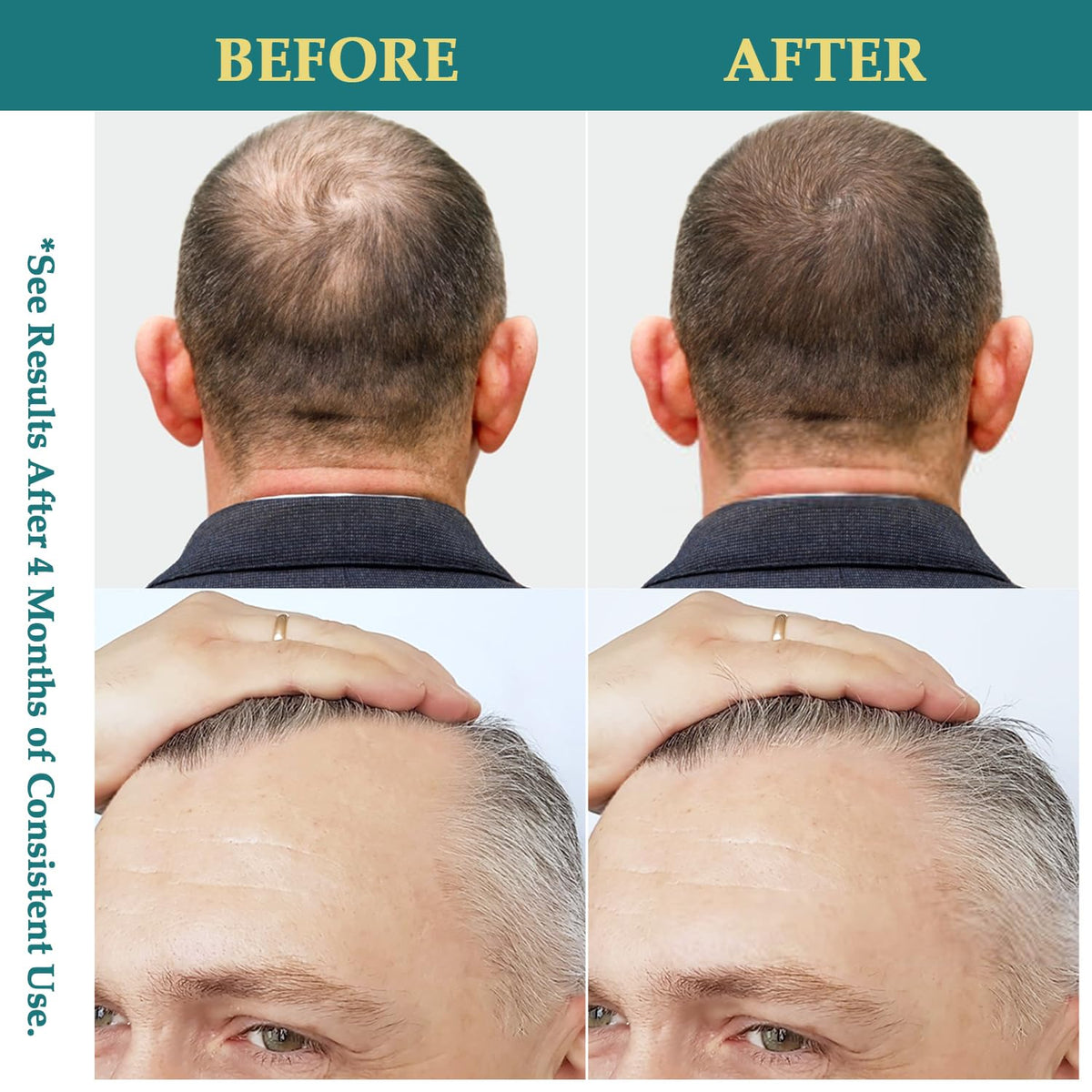 Creip Natural Hair Growth Oil Spray application on hair