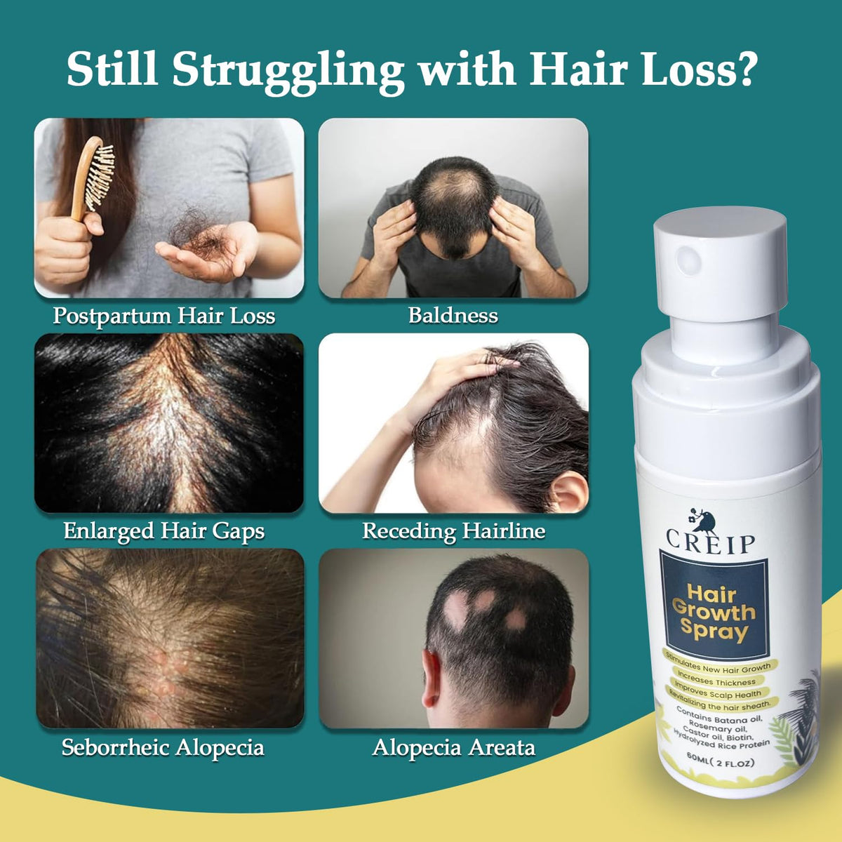 Creip Natural Hair Growth Oil Spray packaging with botanical ingredients