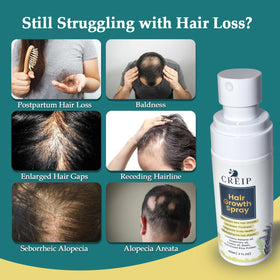 Creip Natural Hair Growth Oil Spray packaging with botanical ingredients