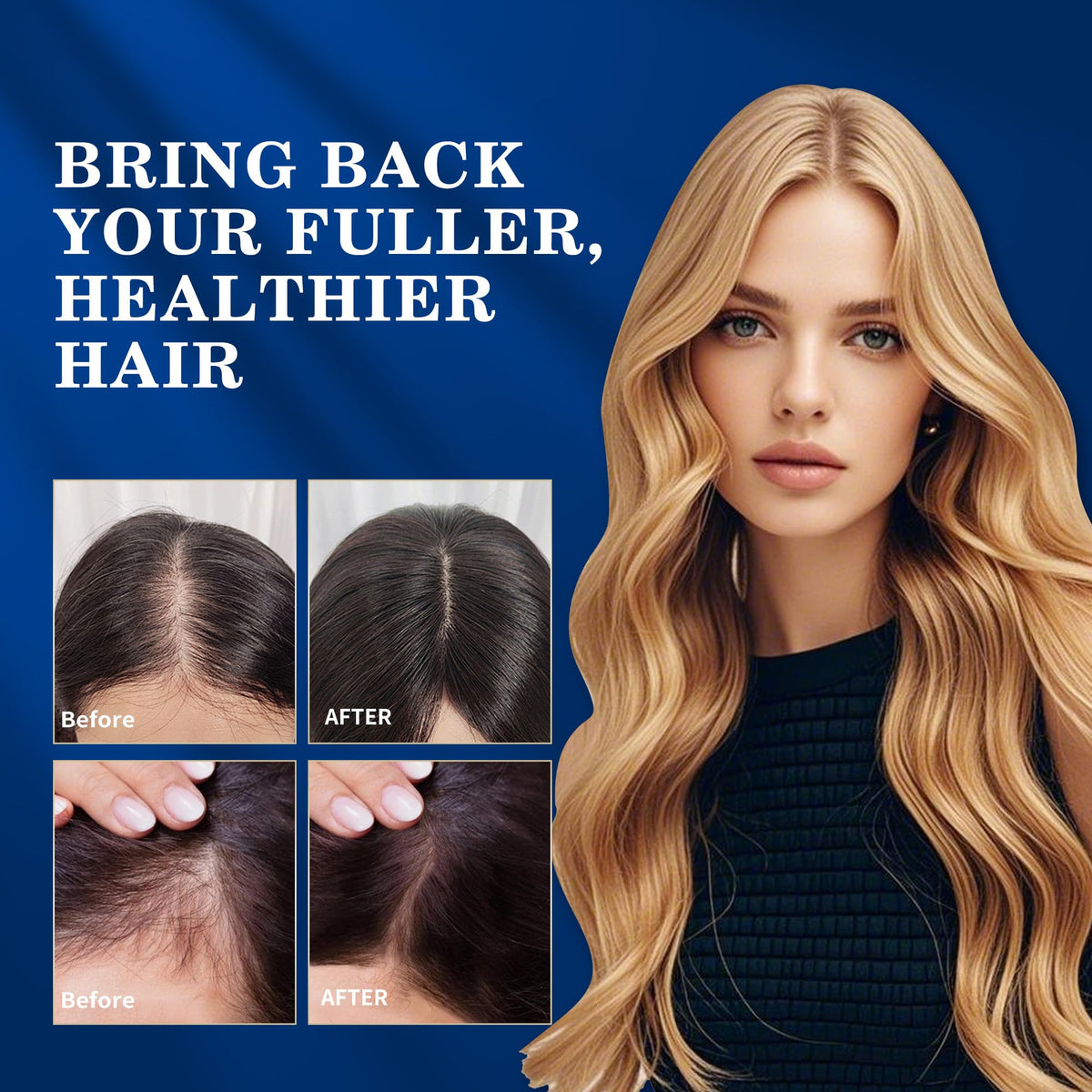 DAAZZS 5% Minoxidil application on scalp