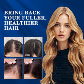 DAAZZS 5% Minoxidil application on scalp