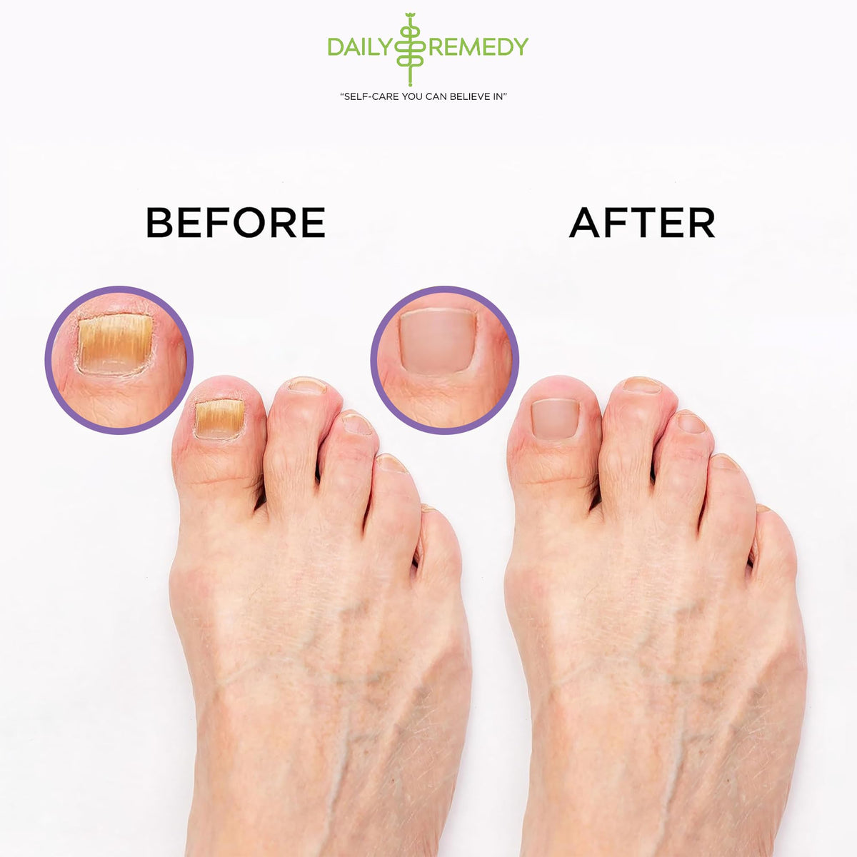 DAILY REMEDY Calming Lavender Foot Soak lifestyle scene