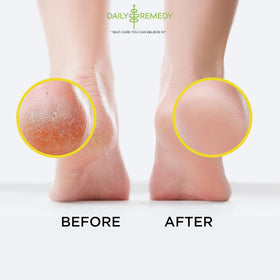 DAILY REMEDY Citrus Detox Foot Soak ingredients list