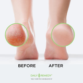 DAILY REMEDY foot soak packaging details