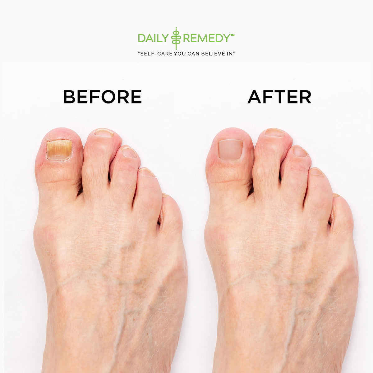 DAILY REMEDY foot soak with Epsom salt and essential oils