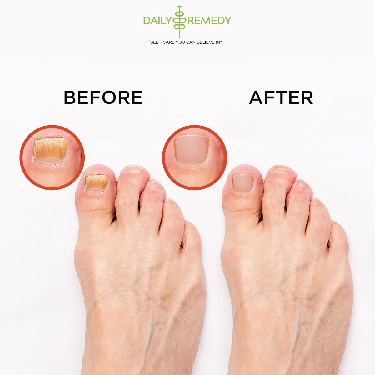 DAILY REMEDY Muscle Relief Foot Soak lifestyle scene