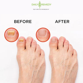 DAILY REMEDY Muscle Relief Foot Soak lifestyle scene