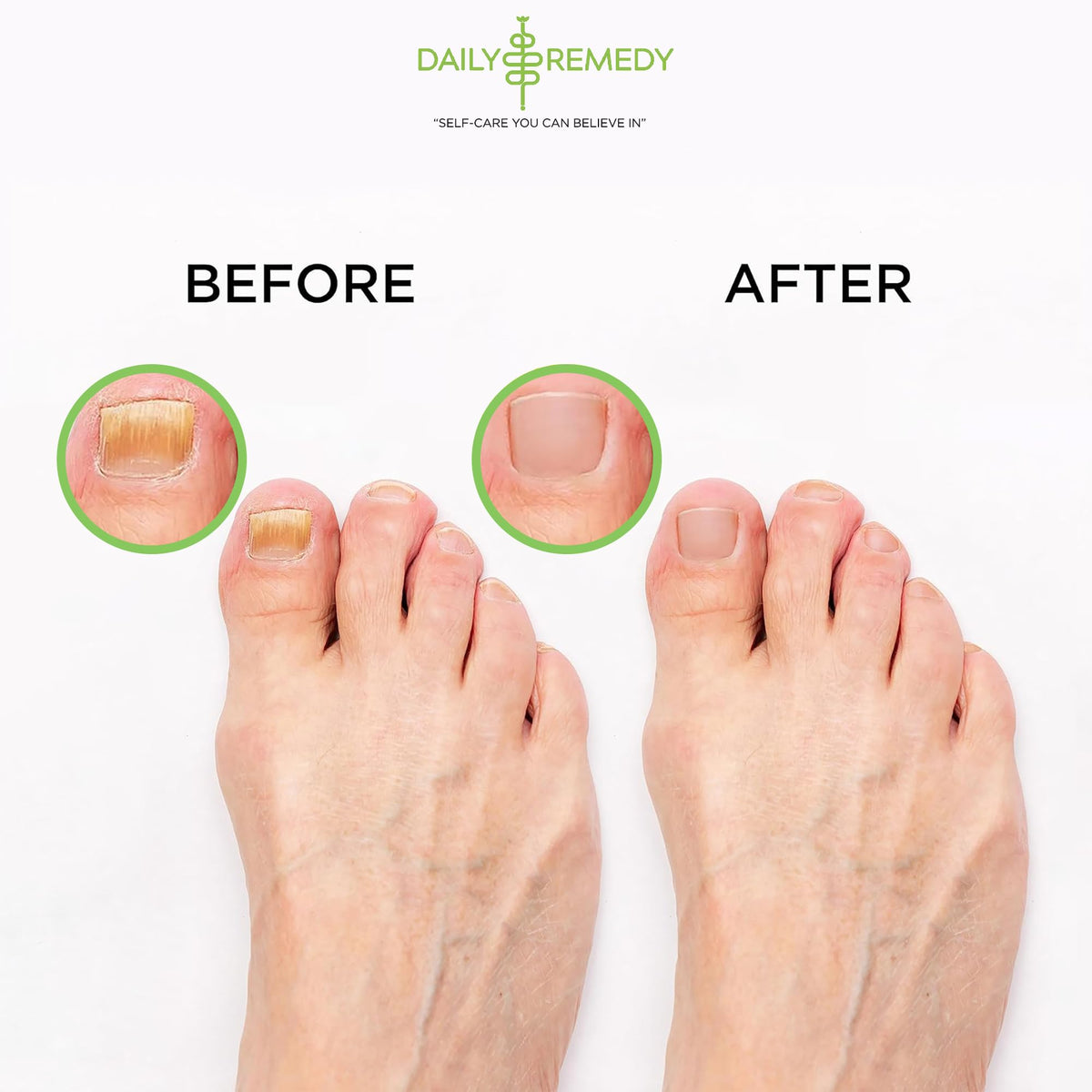 DAILY REMEDY Tea Tree Oil Foot Soak lifestyle scene