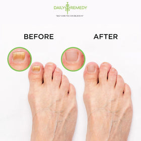 DAILY REMEDY Tea Tree Oil Foot Soak lifestyle scene