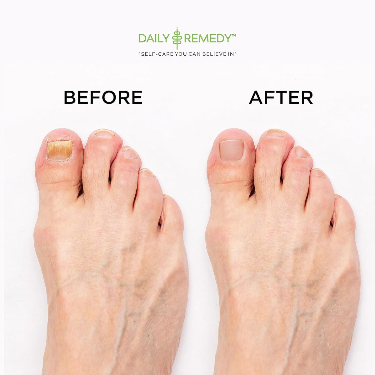 DAILY REMEDY Tea Tree Oil Foot Soak with Epsom salt on a wooden background