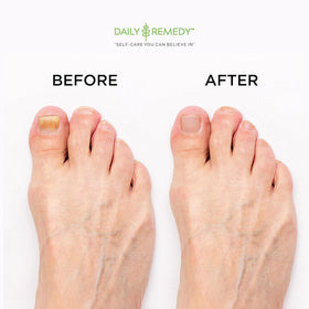 DAILY REMEDY Tea Tree Oil Foot Soak with Epsom salt on a wooden background