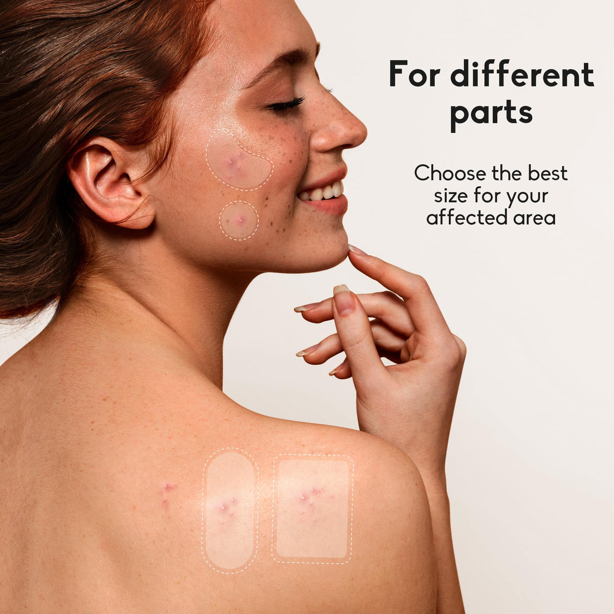 Daolyo Large Acne Pimple Patches oval patches close-up