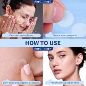 Daolyo Pimple Patches displayed with a skincare routine