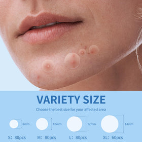 Daolyo Pimple Patches showing various sizes 8mm, 10mm, 12mm, 14mm