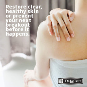 De La Cruz 10% Sulfur Ointment application on skin
