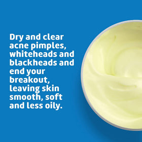 De La Cruz 10% Sulfur Ointment application on skin