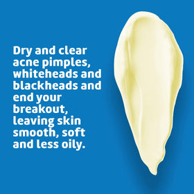 De La Cruz 10% Sulfur Ointment packaging details