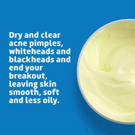 De La Cruz Sulfur Ointment 10% application on skin