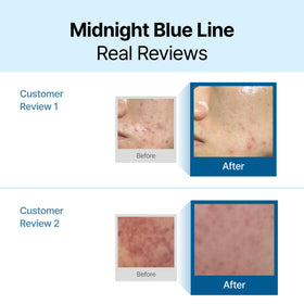 DearKlairs Blue Calming Cream 110g jar side view