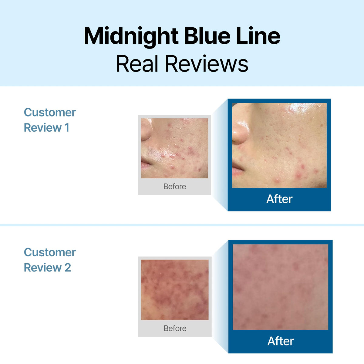 DearKlairs Midnight Blue Calming Cream back view