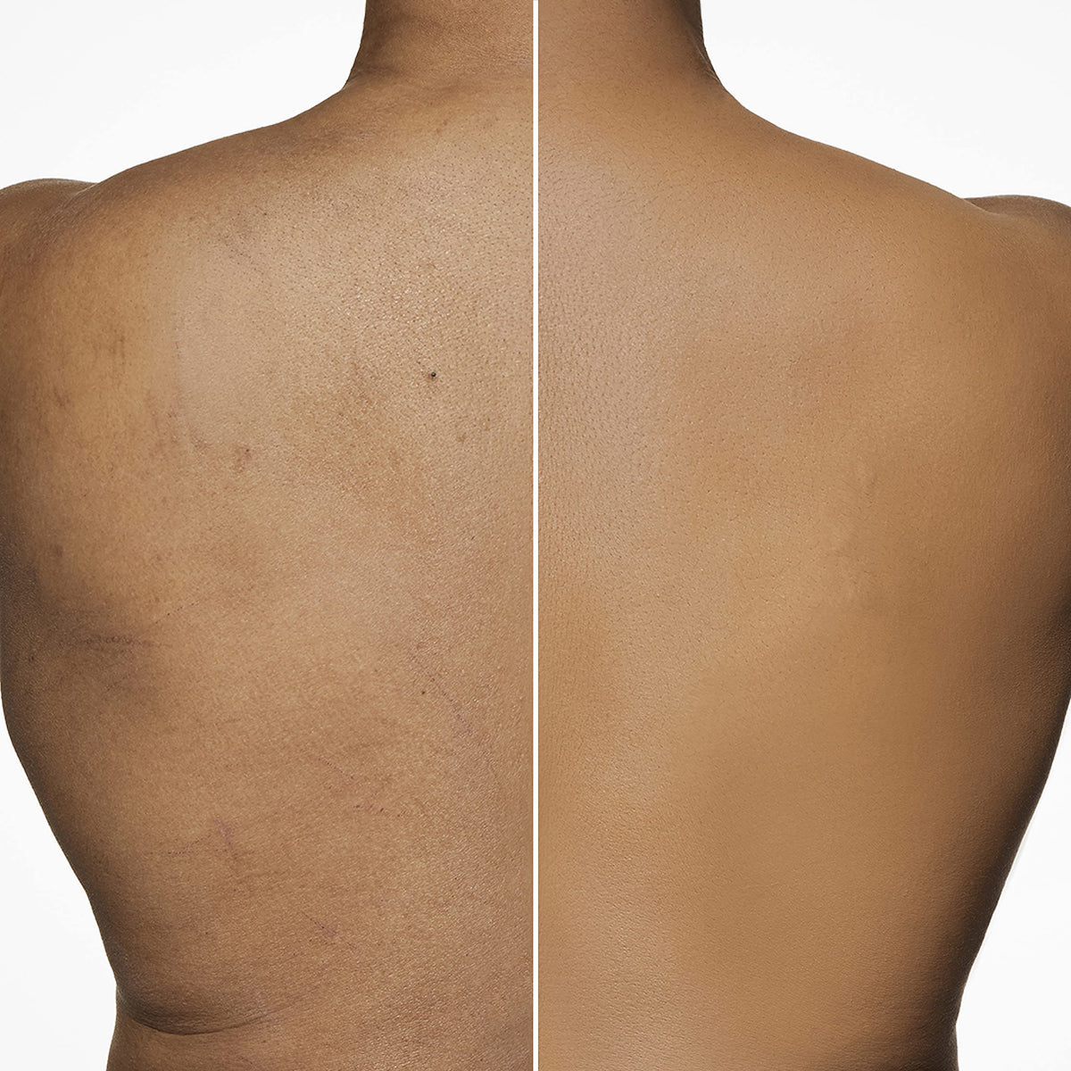 Dermablend Leg & Body Makeup Foundation SPF 25 shade range