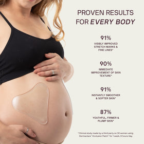 Dermaclara patch applied on belly for stretch mark prevention