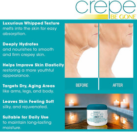 Dermactin Crepe Be Gone Body Souffle jar with lid open