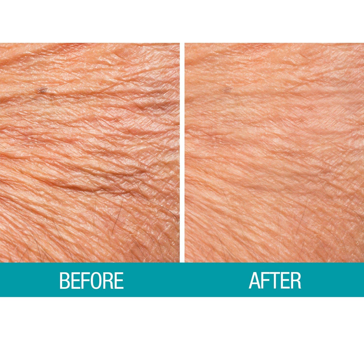 Dermactin Crepe Be Gone Body Souffle texture on hand