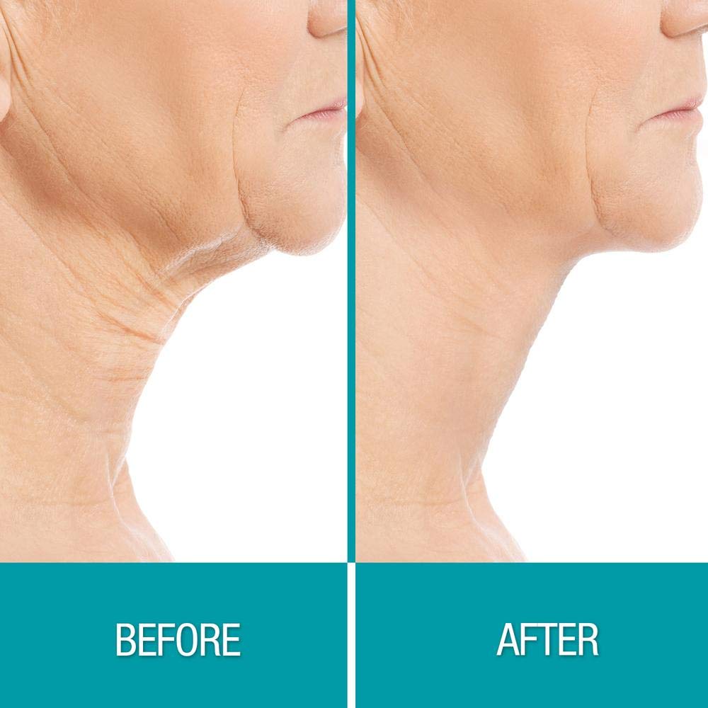 Dermactin Crepe Be Gone Firming Neck Cream ingredients list