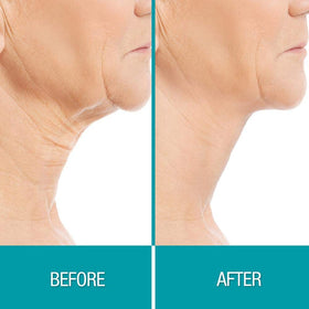 Dermactin Crepe Be Gone Firming Neck Cream ingredients list