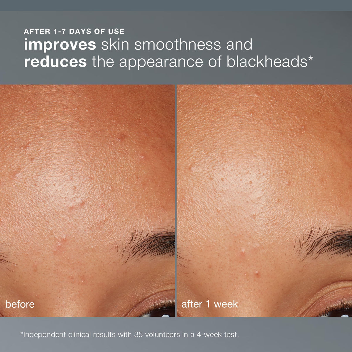 Dermalogica Daily Microfoliant powder texture