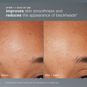 Dermalogica Daily Microfoliant powder texture