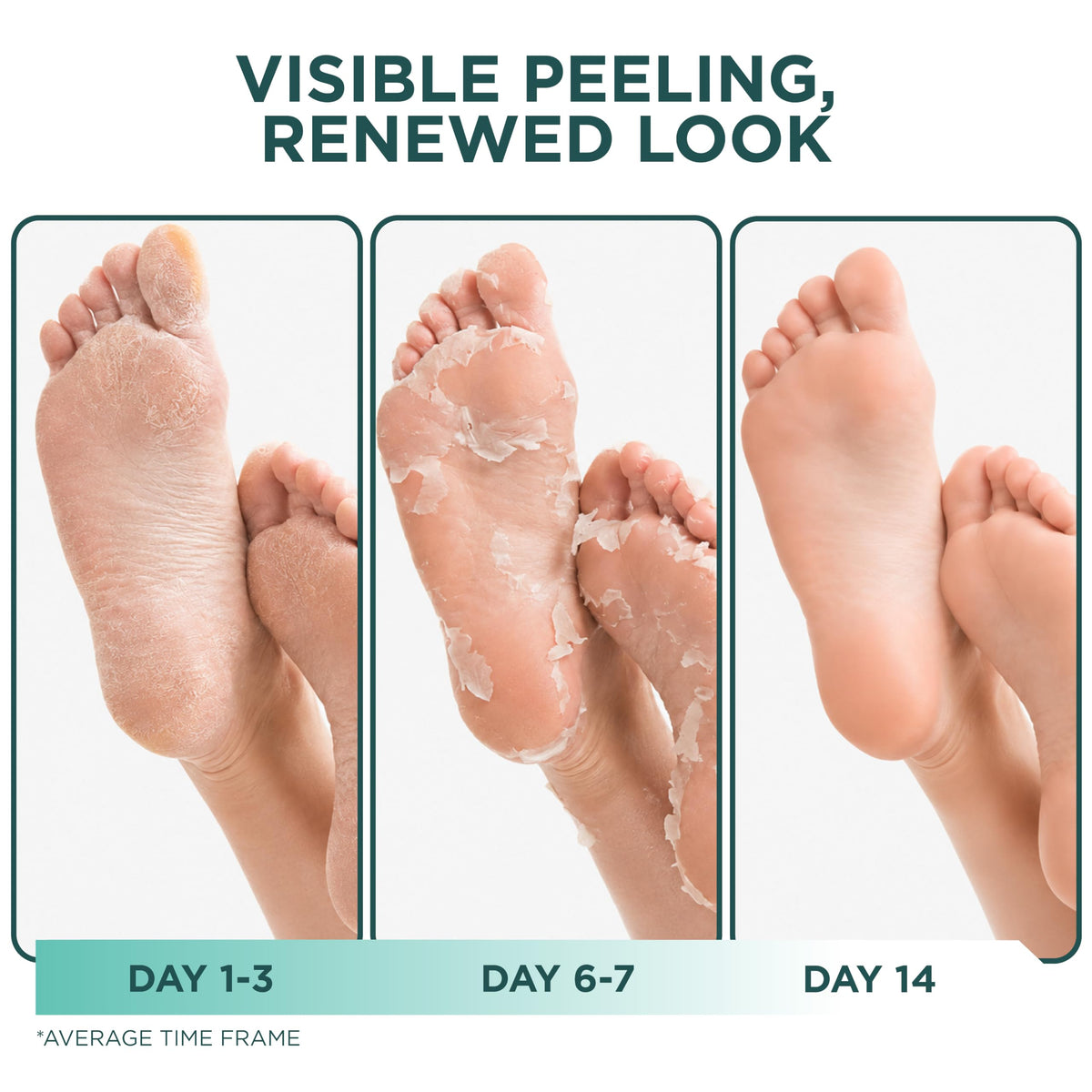 DERMORA Foot Peel Mask booties inside packaging