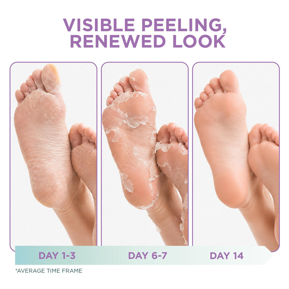 DERMORA Foot Peel Mask Lavender application process