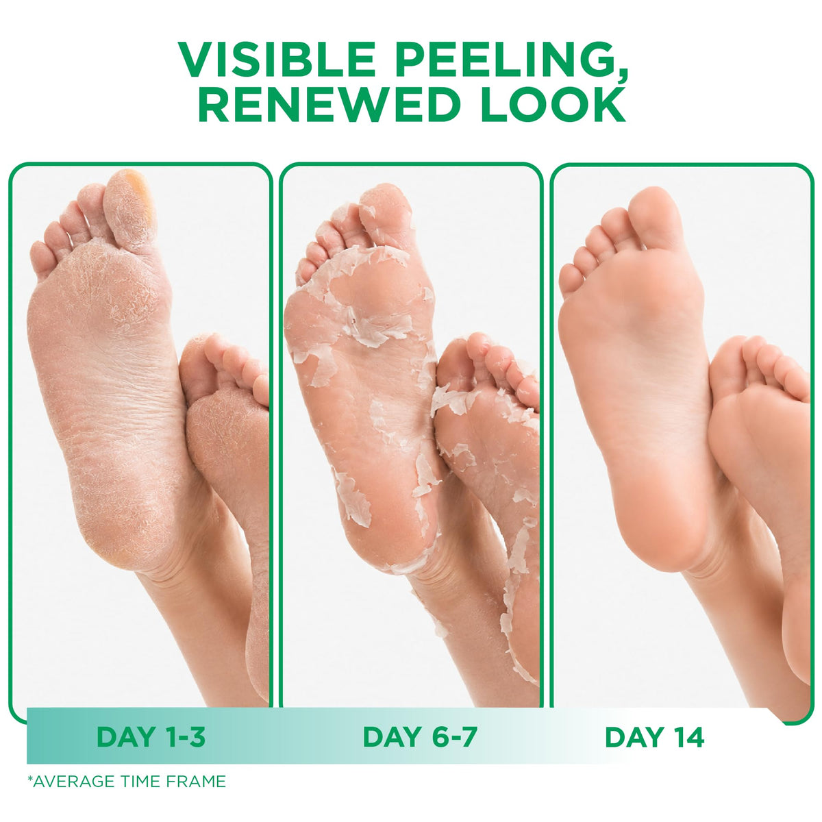 DERMORA Foot Peel Mask showing two pairs of booties