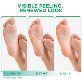 DERMORA Foot Peel Mask showing two pairs of booties