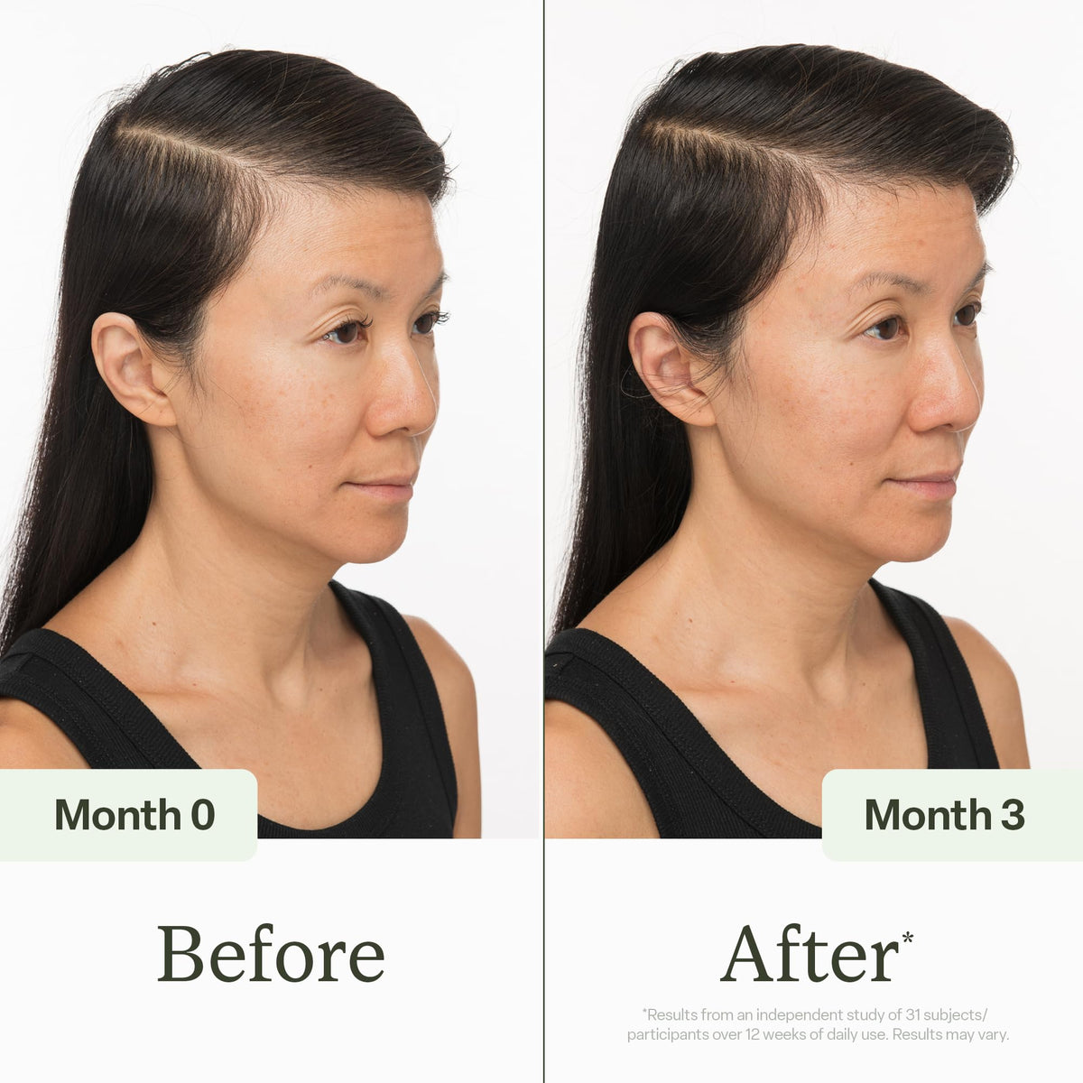 divi Scalp Serum 100 ml with application instructions