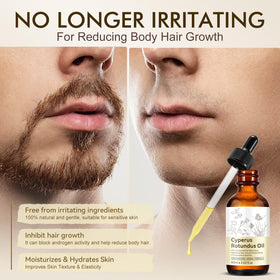 DLOMFVFQ Cyperus Rotundus Oil application on skin