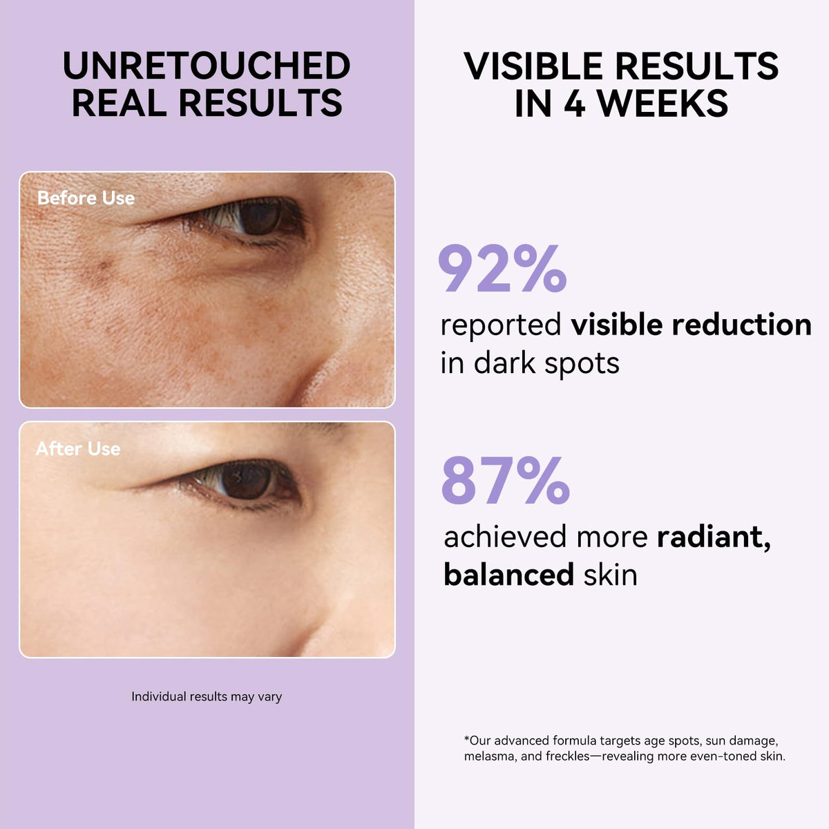 DMYGO Dark Spot Remover Serum back view with ingredient list