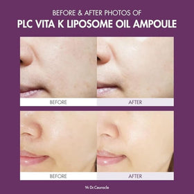 Dr.Ceuracle PLC Vita K Liposome Oil Ampoule bottle with dropper