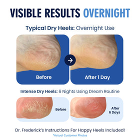 Dr. Frederick's heel socks on a foot, highlighting comfort and fit
