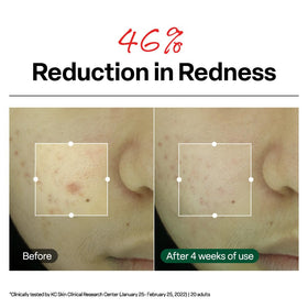 Dr.G R.E.D. Blemish Clear Soothing Face Cream application on skin