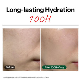 Dr.G R.E.D. Blemish Clear Soothing Face Cream texture close-up