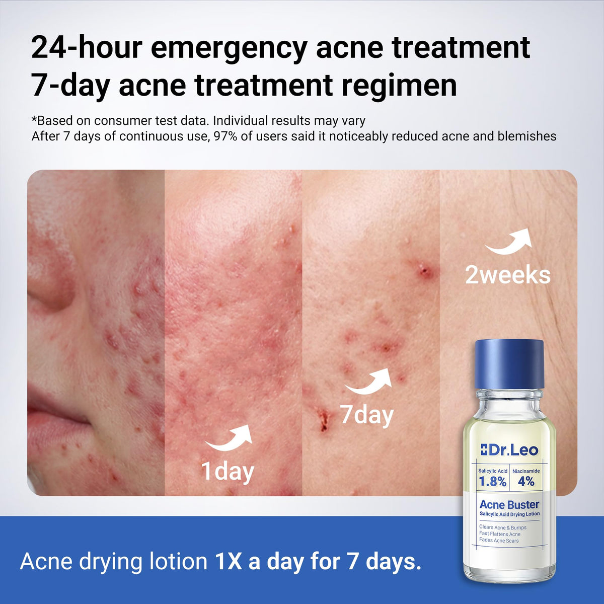 Dr.Leo Acne Spot in a skincare routine