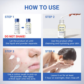 Dr.Leo Acne Spot on a bathroom counter