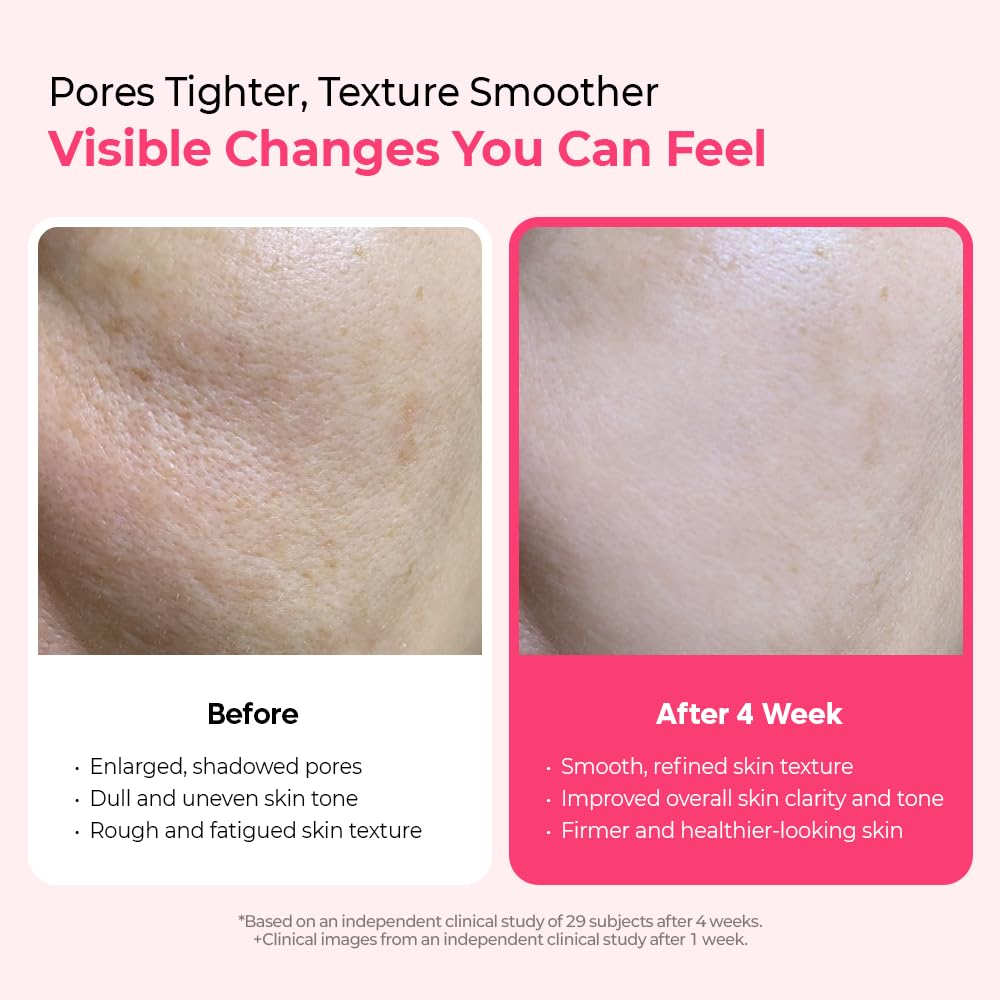 Dr.Melaxin Cyano Pink Spicule Serum application on hand